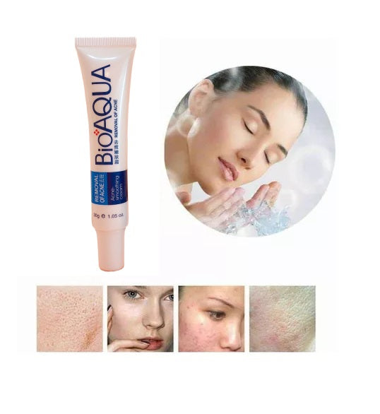 Bioaqua jabón facial anti acné 30g