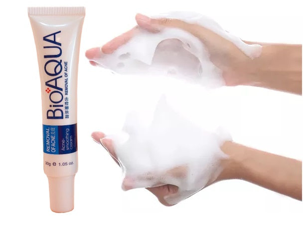 Bioaqua jabón facial anti acné 30g